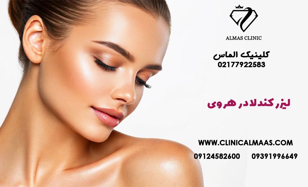 لیزر کندلا در هروی